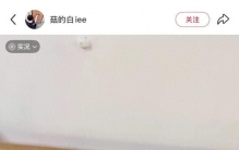 做核磁共振检查，忘了摘“999足金”的金镯子，万万没想到……
