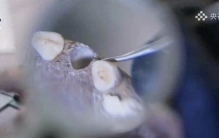 口含小球、拔牙，5000年前的习俗有多怪？