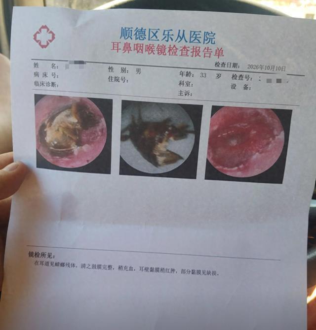 33岁男子睡梦中蟑螂钻进耳道，死在耳朵里近一周就医，医生：左耳耳膜险穿孔，听力受影响