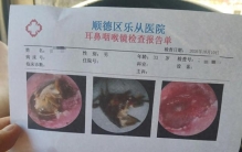 33岁男子睡梦中蟑螂钻进耳道，死在耳朵里近一周就医，医生：左耳耳膜险穿孔，听力受影响
